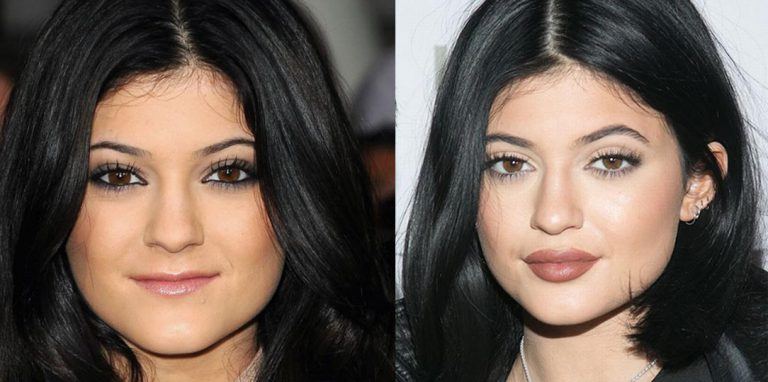 How to Make Thin Lips Look Bigger Naturally